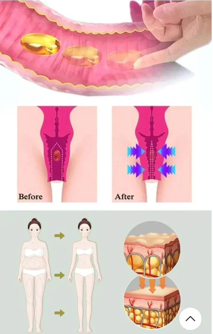Gélules BioNaturelles de réparation vaginale