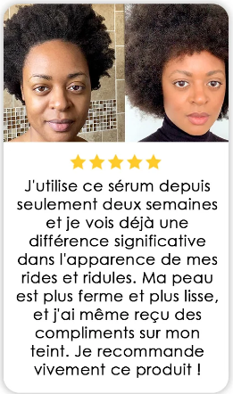 Sérum the ordinary(Niacinamide) BKF