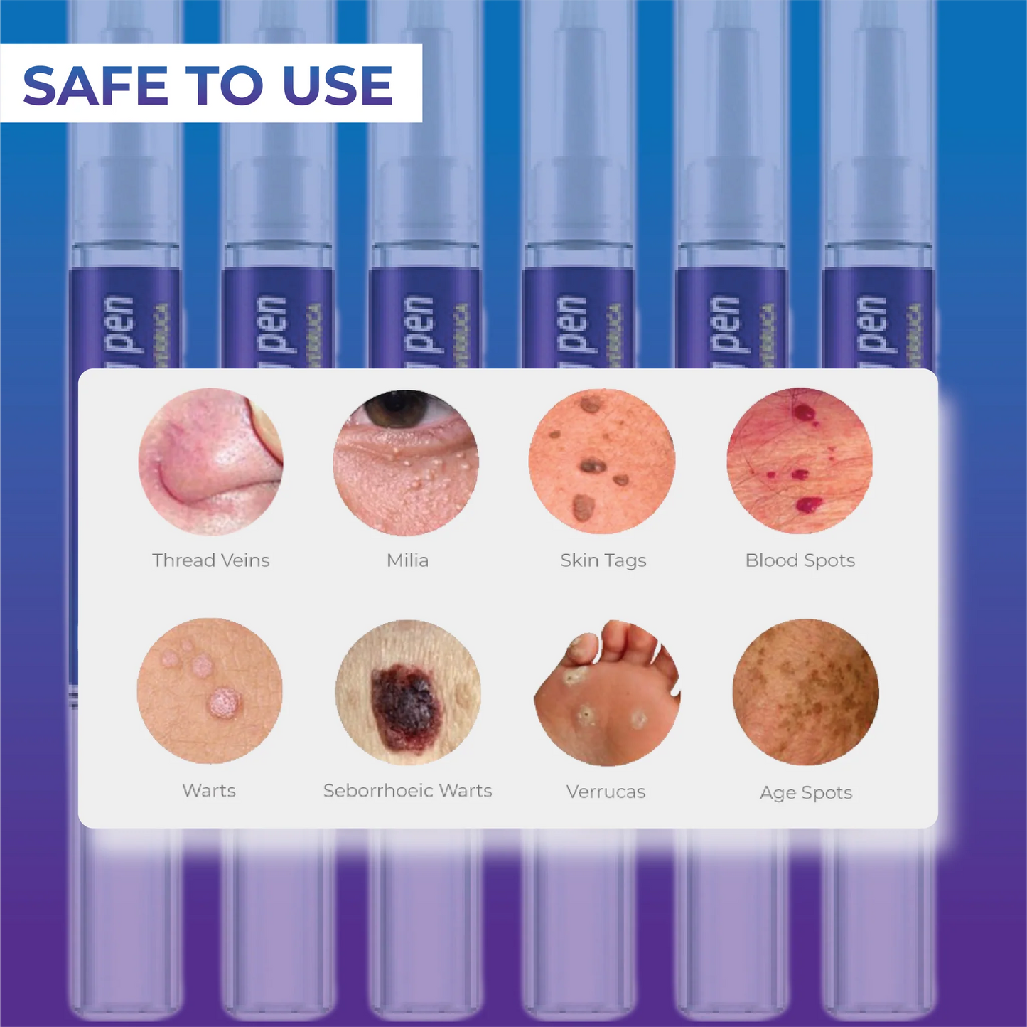 Stylo pour enlever les étiquettes de peau et les verrues