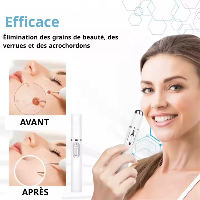 Stylo Laser ProMax – Grains & Verrues KO!