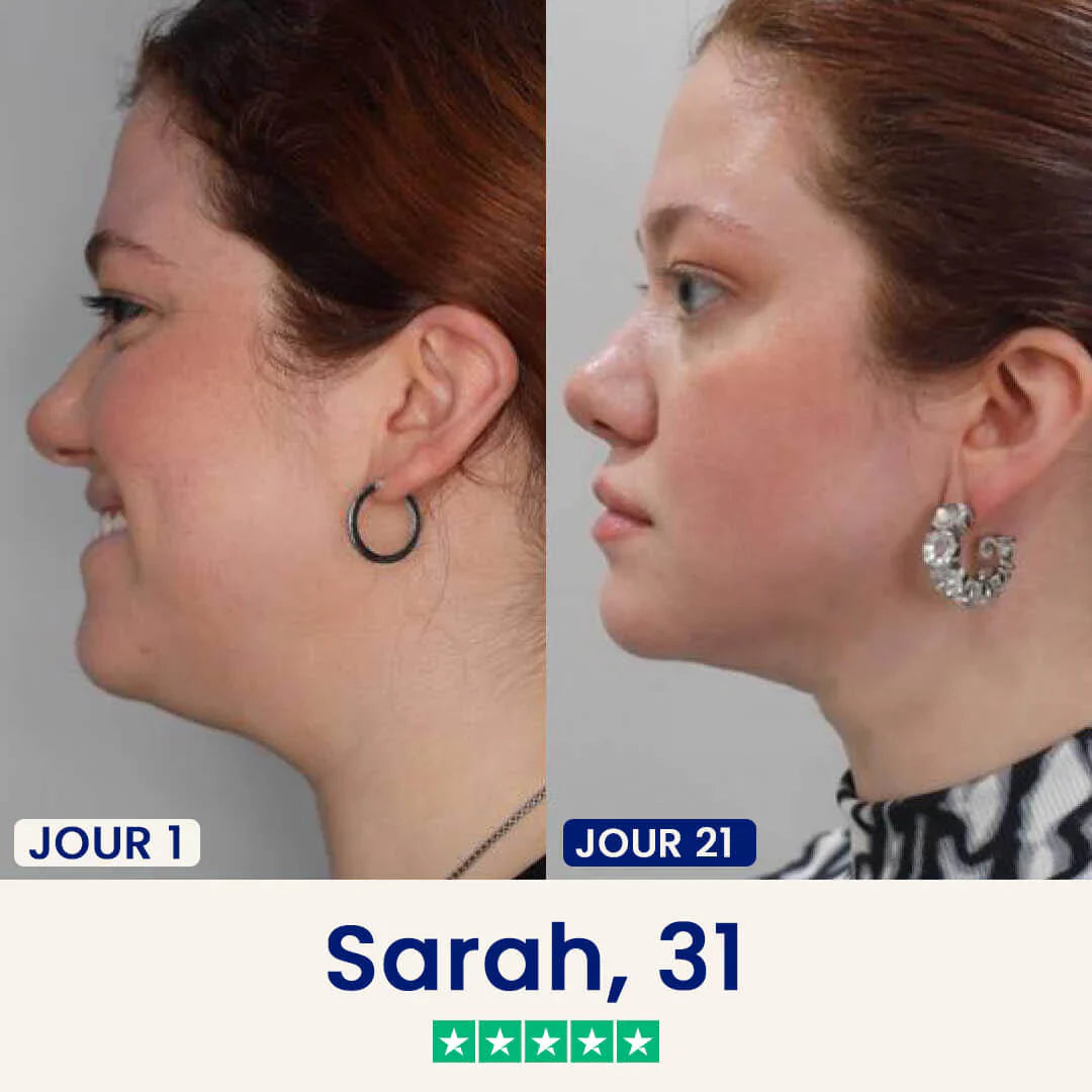 Le Masque Lift : Dites adieu à votre double menton dès maintenant.