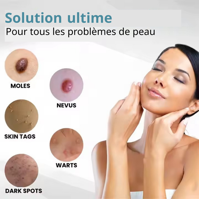 Stylo Laser ProMax – Grains & Verrues KO! CIV